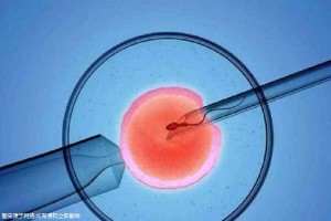 供卵代生医院